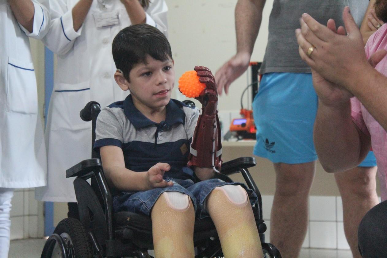 Menino de 7 anos ganha prótese de mão em 3D inspirada no Homem-Aranha em RO