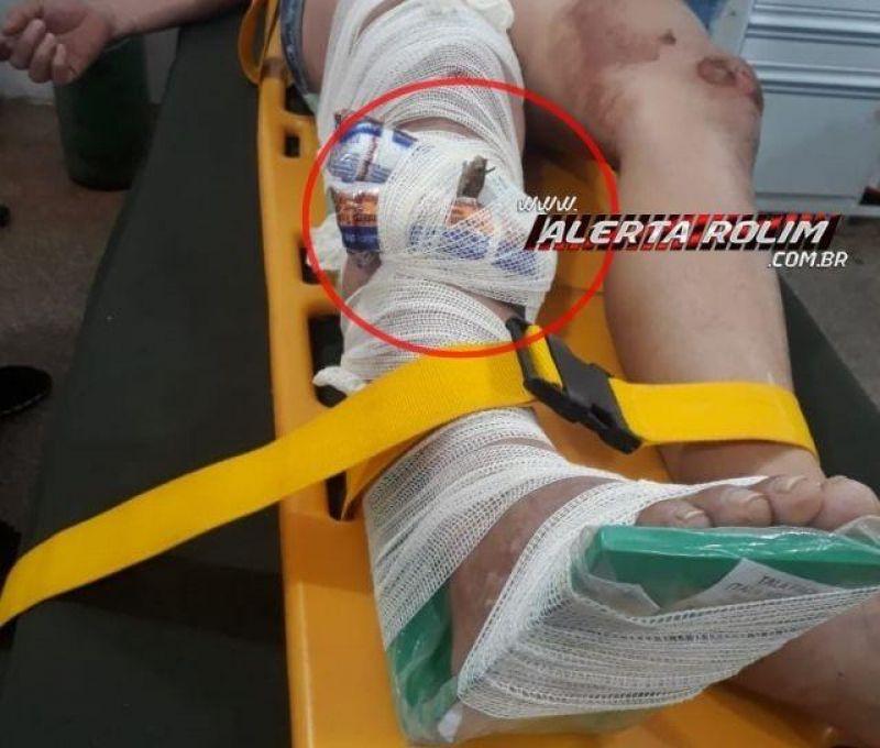 Rolim de Moura - Galho de árvore cai sobre mulher enquanto trafegava de moto e um graveto fica cravado em sua perna
