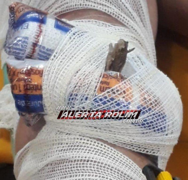 Rolim de Moura - Galho de árvore cai sobre mulher enquanto trafegava de moto e um graveto fica cravado em sua perna