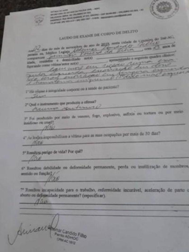 Policiais Militares do Acre são acusados de torturar estudante homossexual Policiais Militares do Acre são acusados de torturar estudante homossexual