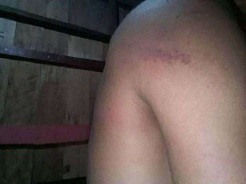 Policiais Militares do Acre são acusados de torturar estudante homossexual Policiais Militares do Acre são acusados de torturar estudante homossexual