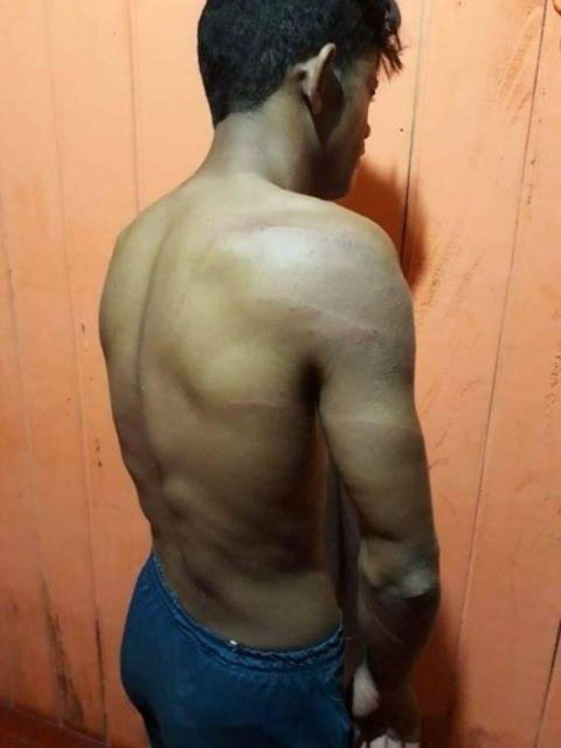 Policiais Militares do Acre são acusados de torturar estudante homossexual Policiais Militares do Acre são acusados de torturar estudante homossexual