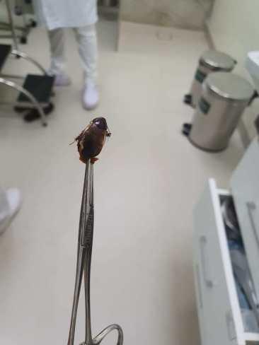 Incrível: Médico relata caso de barata viva em ouvido de paciente no Acre