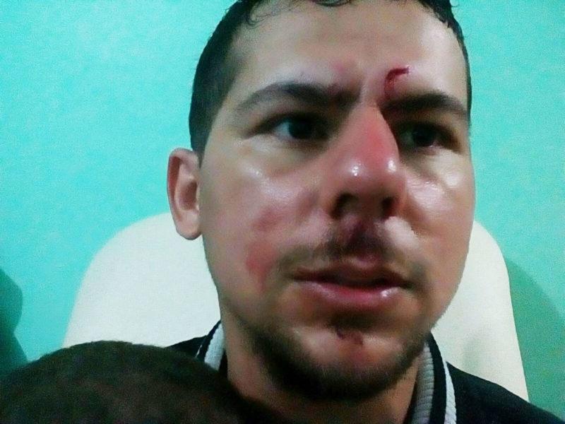 Sobrevivente conta como foi acidente entre ônibus e carreta em Vilhena