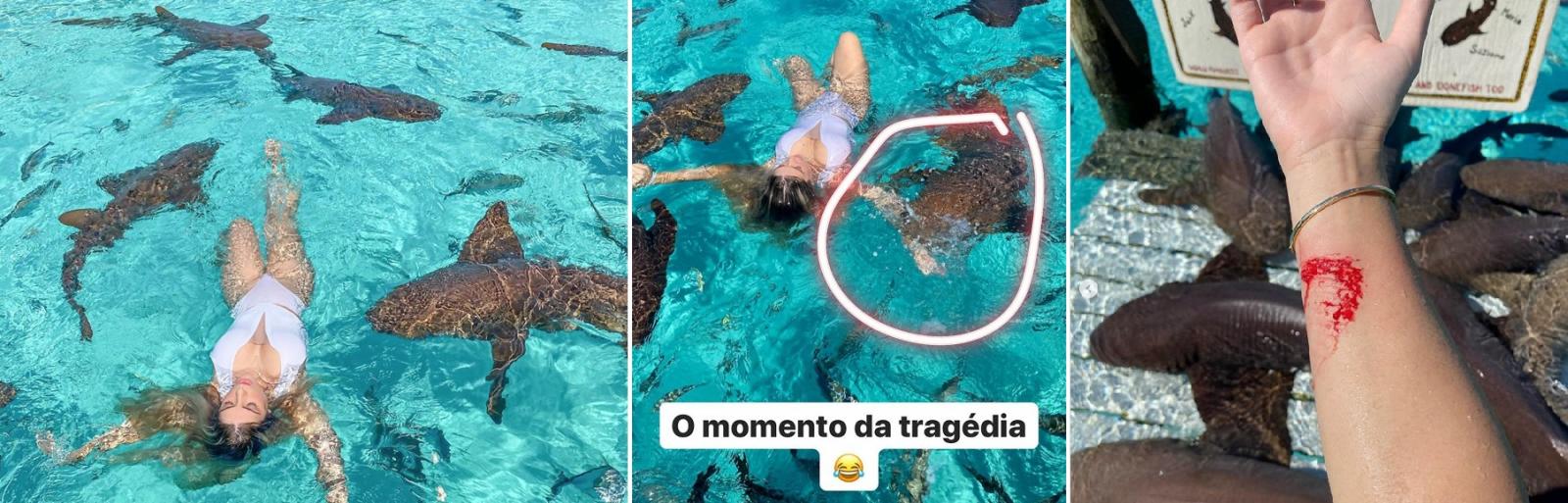 Digital influencer é mordida por tubarão nas Bahamas e posta foto do momento na internet Digital influencer é mordida por tubarão nas Bahamas e posta foto do momento na internet