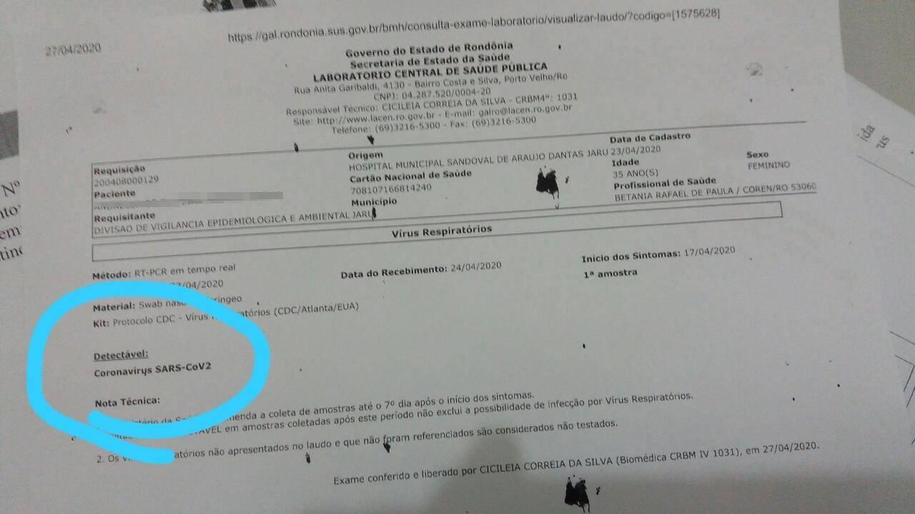 Paciente com Covid-19 será investigada por descumprir isolamento e participar de confraternização com várias pessoas em Jaru
