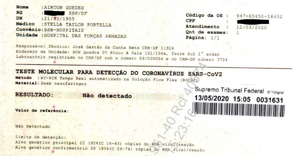 Bolsonaro usou pseudo nomes (nomes falsos) para fazer exames de coronavírus; Confira o resultado