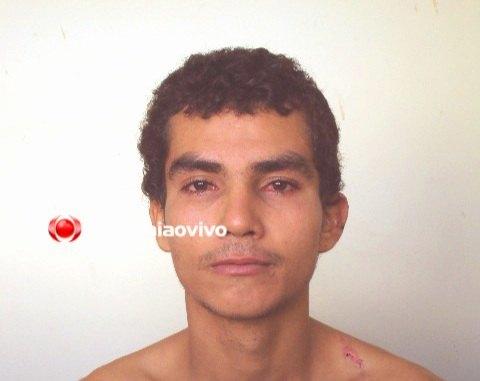 Polícia prende morador de rua que tacou pedra em acadêmica de medicina; Ela teve afundamento de crânio