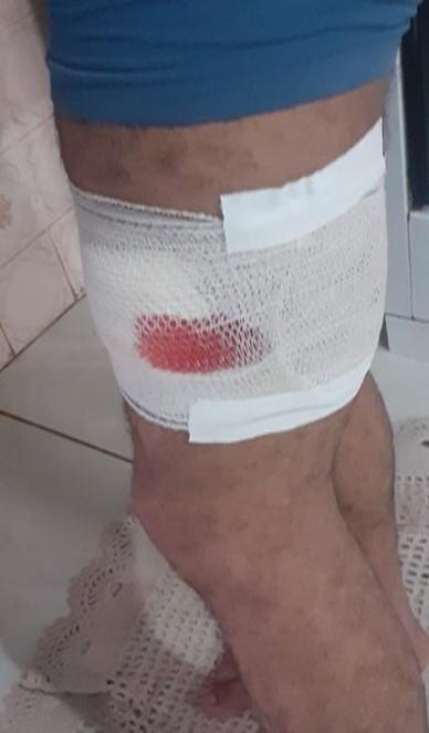 SANEROM pede ajuda da população para que coletores de lixo não sejam atacados por cães ou atropelados