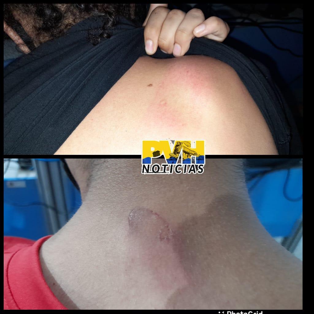 Tio agride sobrinhos com facão por causa de bateria em Porto Velho Tio agride sobrinhos com facão por causa de bateria em Porto Velho