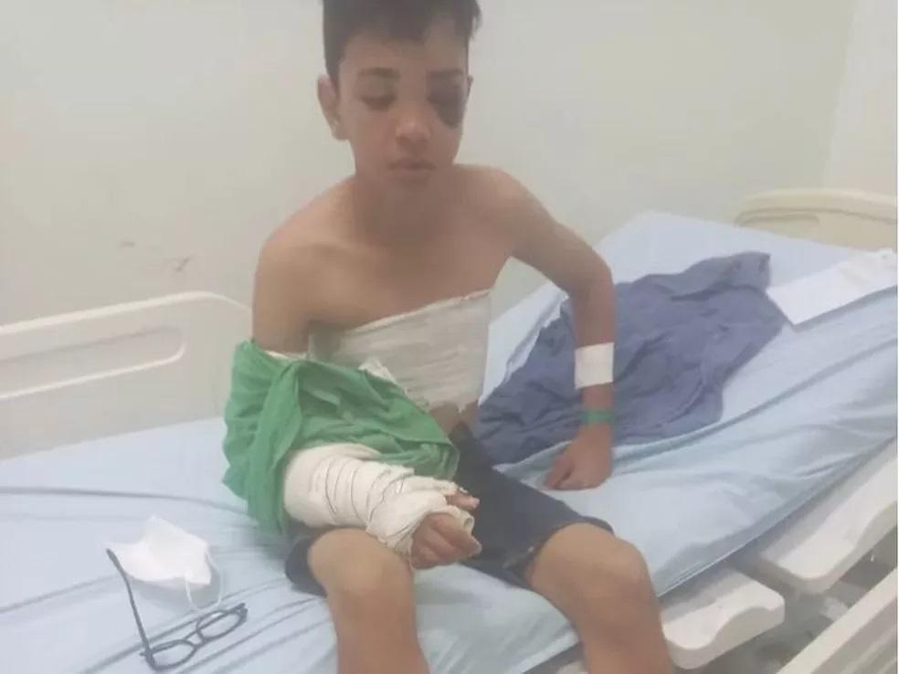 Criança que fraturou crânio ao cair de telhado volta para casa: Criança que fraturou crânio ao cair de telhado volta para casa: