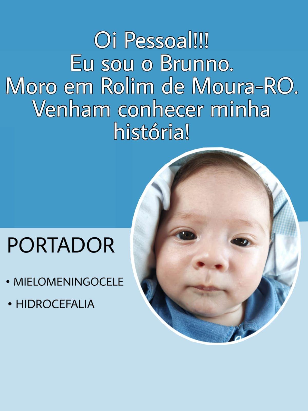 URGENTE: Criança de Rolim de Moura precisa de R$ 95 mil reais para tratamento URGENTE: Criança de Rolim de Moura precisa de R$ 95 mil reais para tratamento