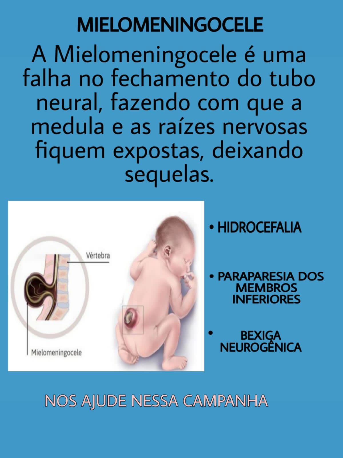 URGENTE: Criança de Rolim de Moura precisa de R$ 95 mil reais para tratamento URGENTE: Criança de Rolim de Moura precisa de R$ 95 mil reais para tratamento