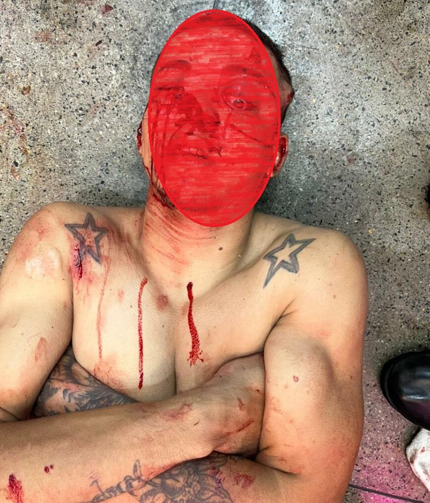 Assaltante leva tiro nos olhos de Assaltante leva tiro nos olhos de