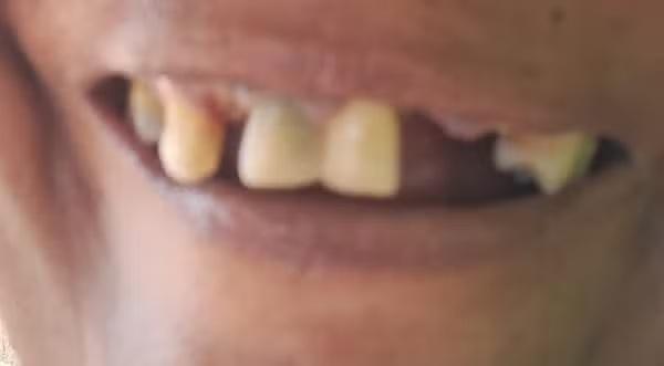 Franquia e dentista são alvos de ação milionária por esquema que causou danos a pacientes em RO Franquia e dentista são alvos de ação milionária por esquema que causou danos a pacientes em RO
